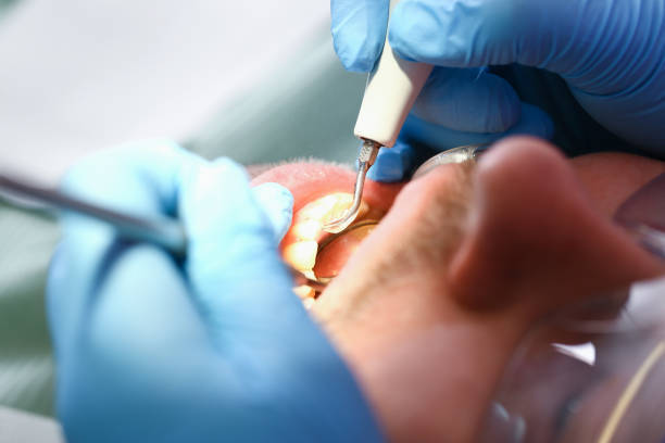 Best Broken Tooth Emergency  in Lansdowne, MD